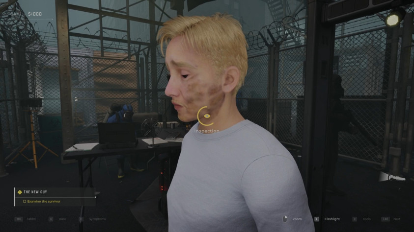 На&amp;nbsp;деле синяки могут встречаться и&amp;nbsp;на&amp;nbsp;других частях тела.