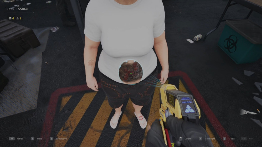 Так выглядит некроз.