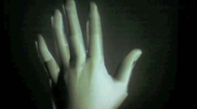1: Первая визуализация головы; 2: Визуализация руки; 3:Гипсовая рука