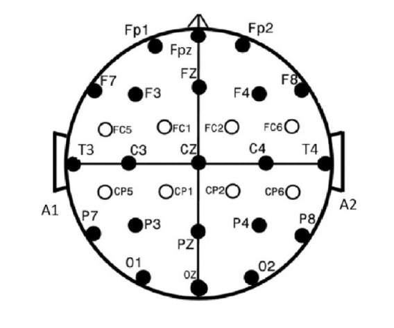 Схема расположения электродов на голове по системе 10-20